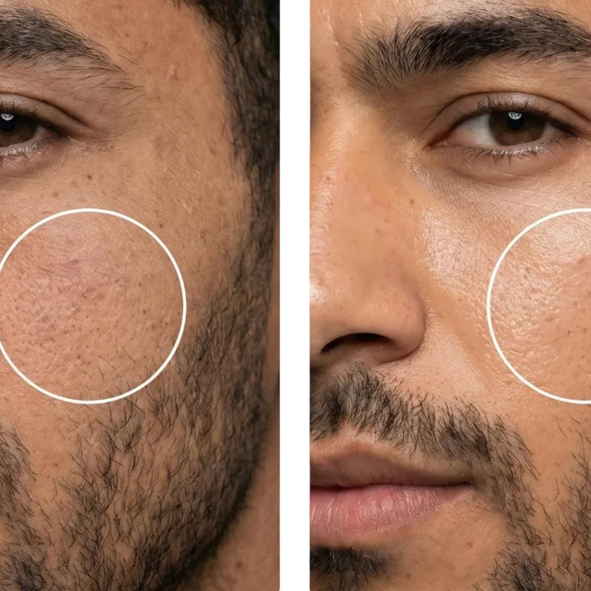 All-In-One Facial Oil - Before After Transformation | OLIRS Men's Skincare